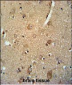 CCZ1 Antibody (Center)